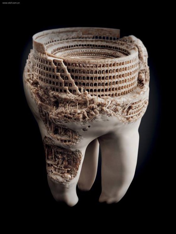 კბილზე ნაკვეთი რომის კოლიზეუმი